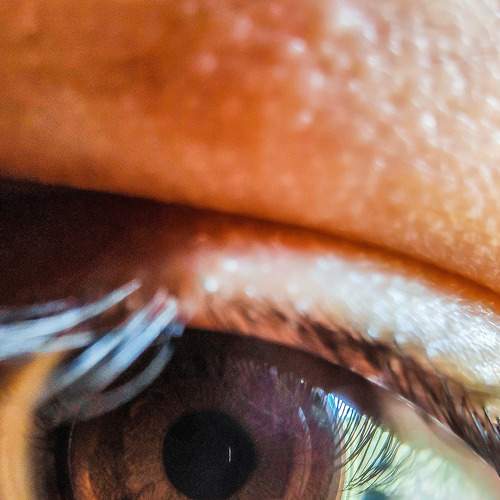 Retina