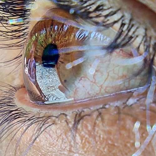 Human eye