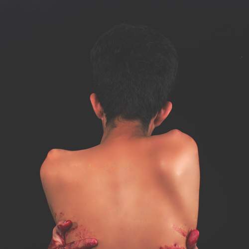 Photo #8559123