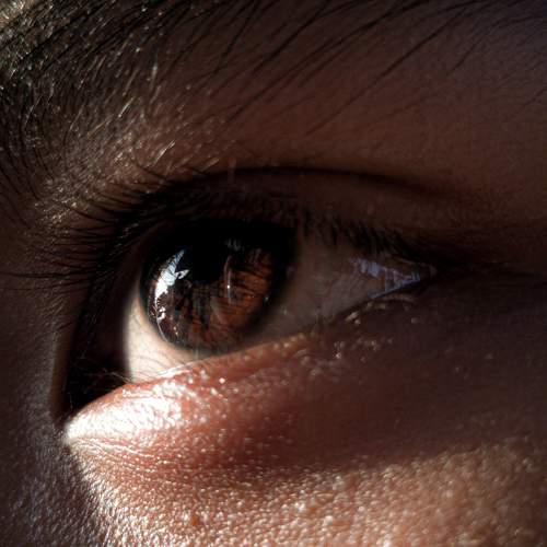 Visions