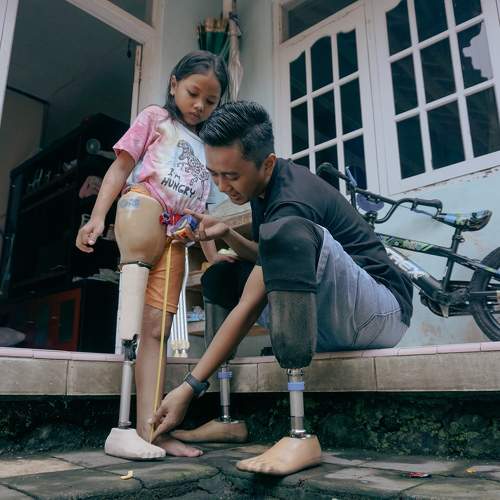 prosthetic leg maker