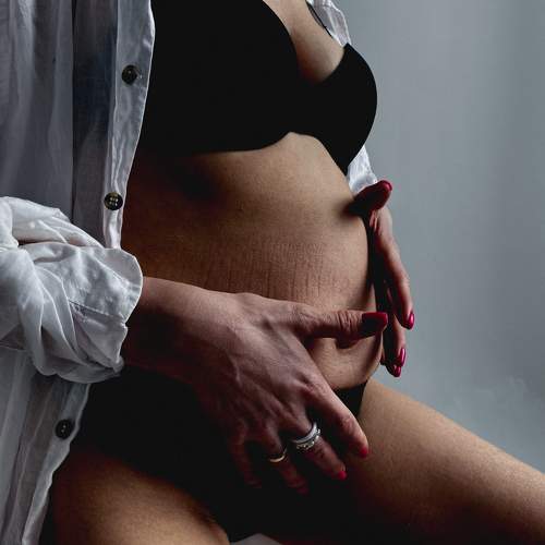 Photo #10920073