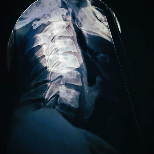 Photo #11756735