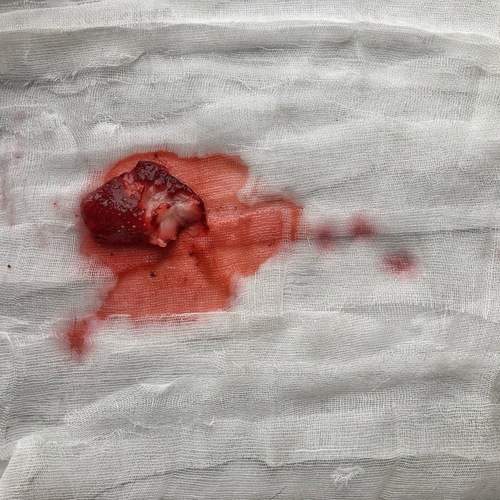 Photo #11893085