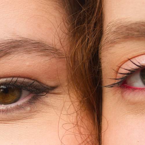 Photo #12590785
