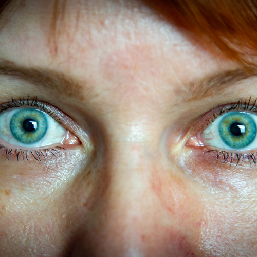 A detailed wide macro portrait showing expressive wide open blue green eyes of a red haired adult woman looking directly at camera
