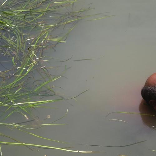 the floating bald