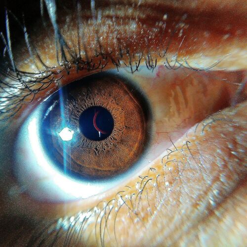 My eye