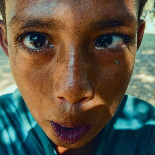 Slum Kid