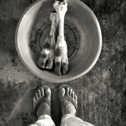 Two different Stories of Pairs Of Legs