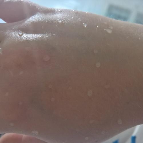 Water on the hand