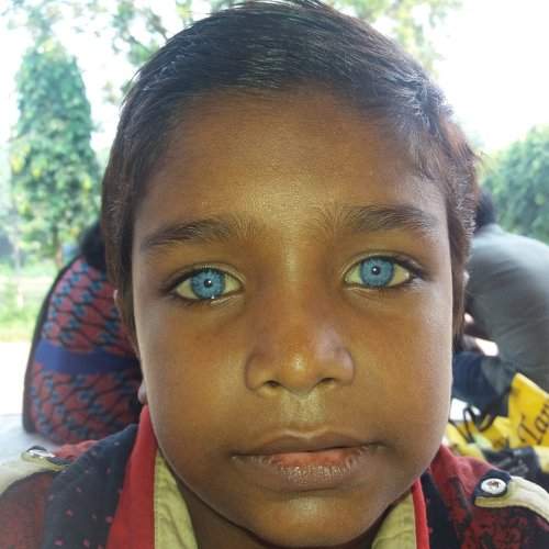 Blue Eyes