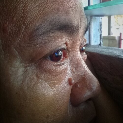 Sorrow seen on the eyes