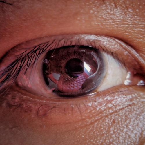 Eye on me