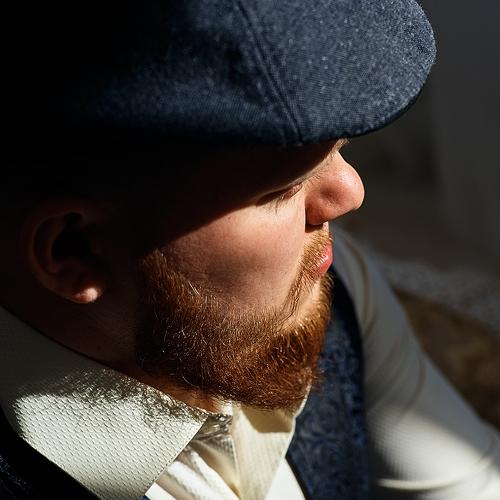 Острые козырьки