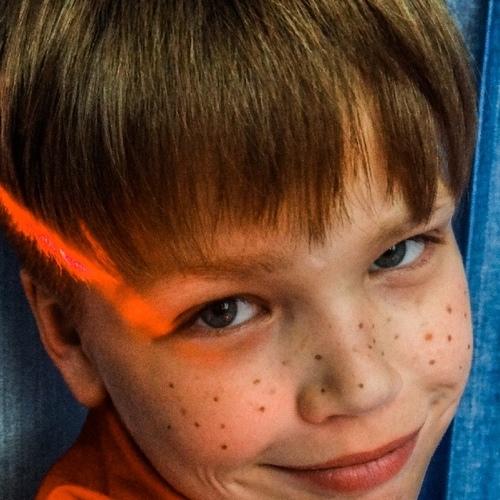 Веснушки