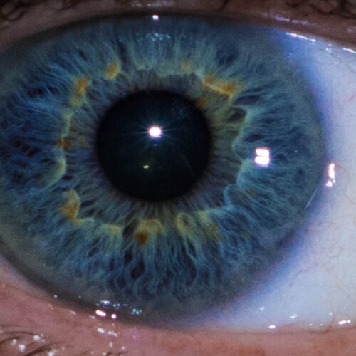 Blue eye