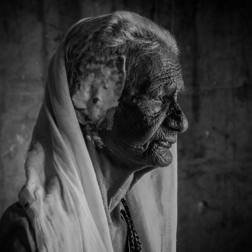 Wrinkles of wisdom