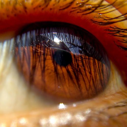Sunshine eye