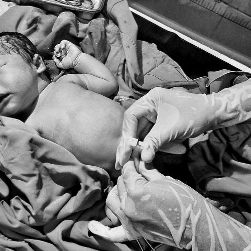 Exhaling umbilical cord.