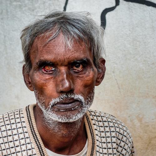 The One Eyed Man