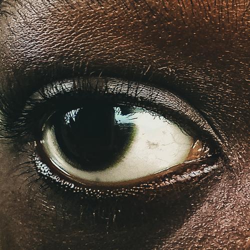Eyes of courage